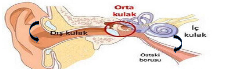 iç kulak sıkışması nedir, iç kulak sıkışması